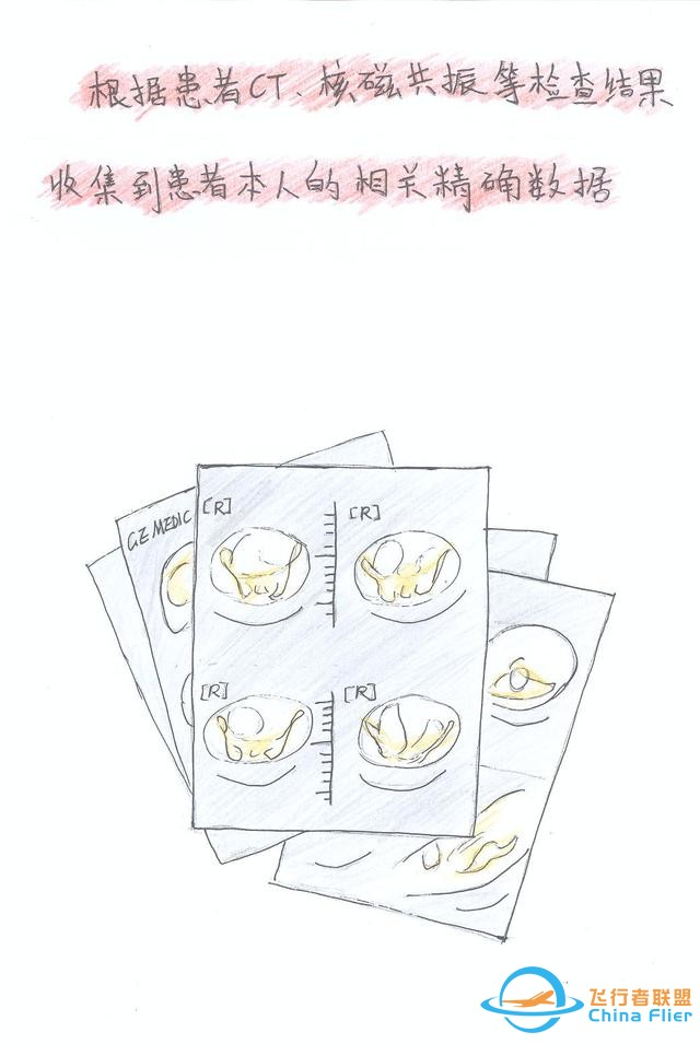 醫(yī)學(xué)領(lǐng)域的“AR 3D”技術(shù)究竟有多炫？10幅手繪漫畫給你講透-3029