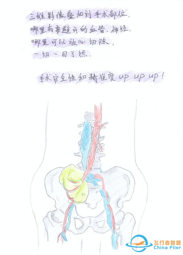 醫(yī)學(xué)領(lǐng)域的“AR 3D”技術(shù)究竟有多炫？10幅手繪漫畫給你講透-8866